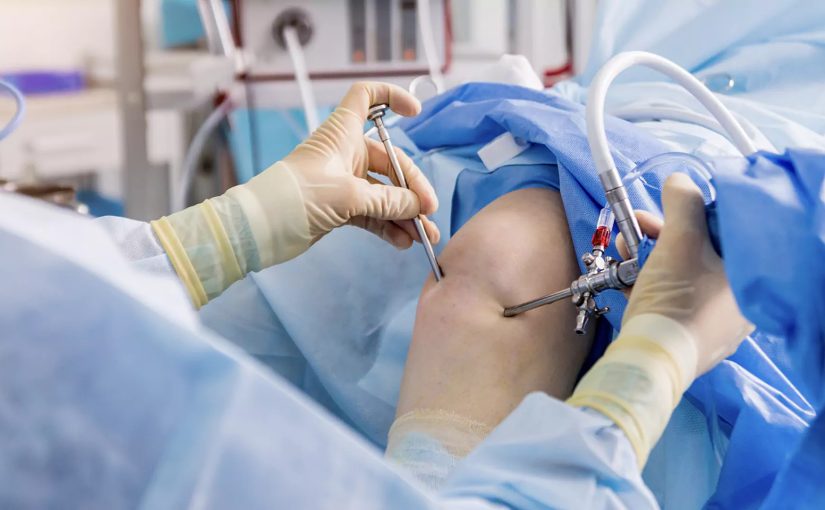 arthroscopy