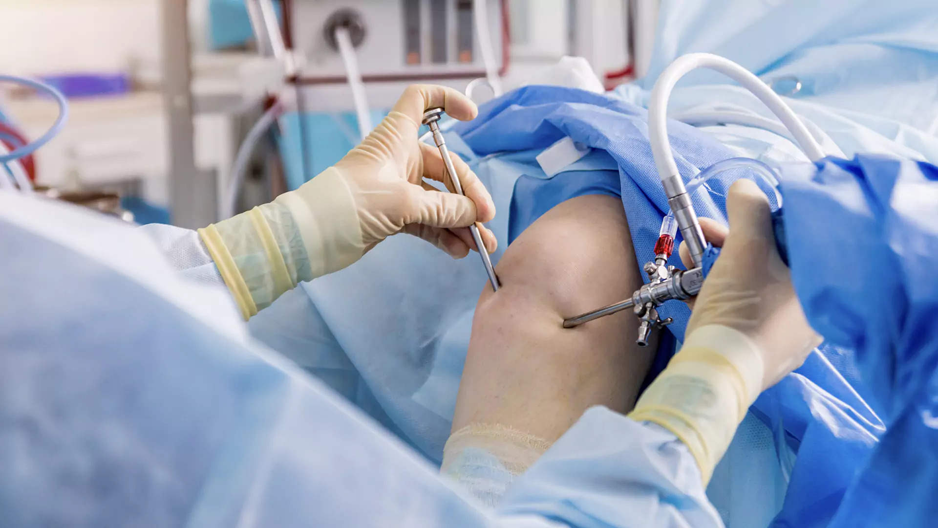 arthroscopy